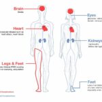 The Connection Between Diabetes and Heart Health