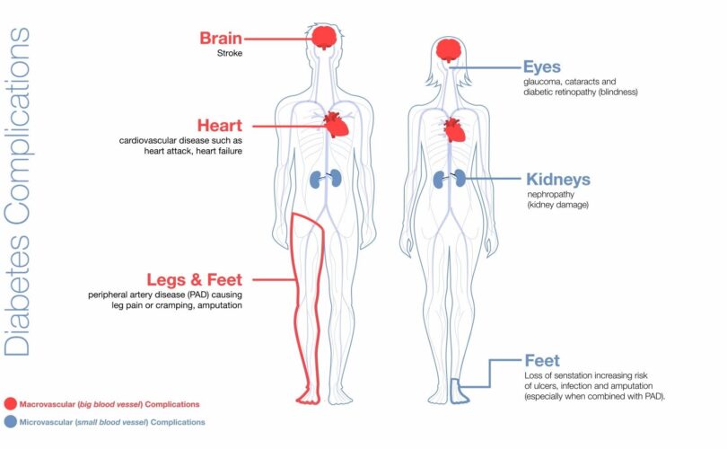The Connection Between Diabetes and Heart Health